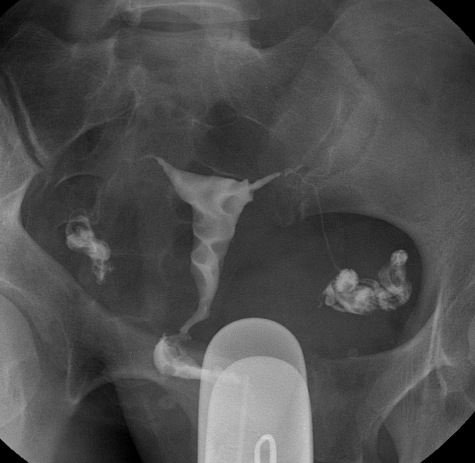 투시조영술 (Fluoroscopy)