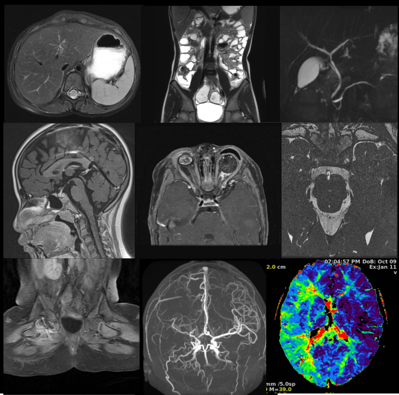 자기공명영상 (MRI, magnetic resonance image)