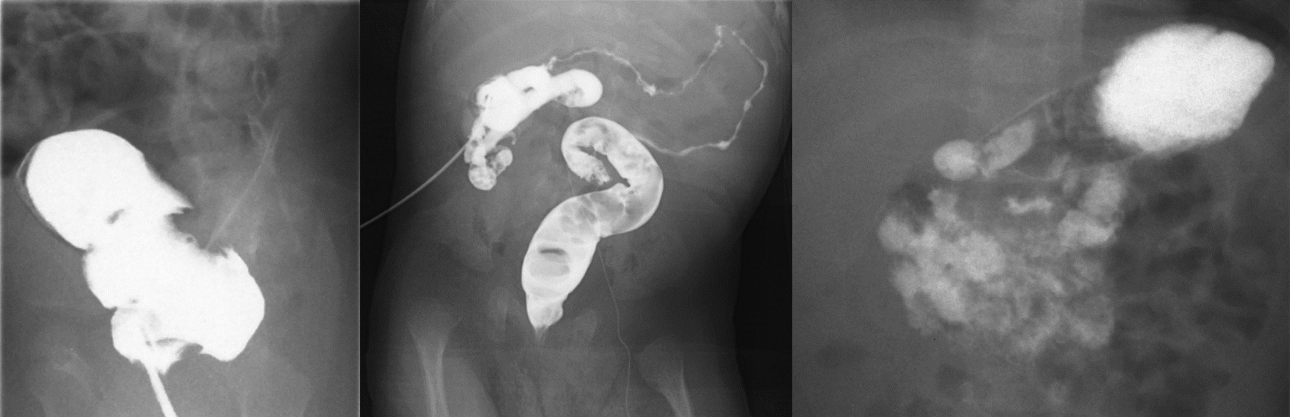 투시 조영 검사 (Fluoroscopy)